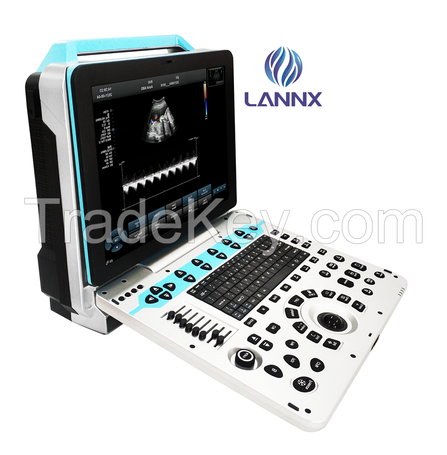 Portable color doppler ultrasound scanner