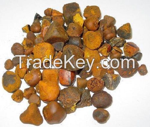 Best Gallstone