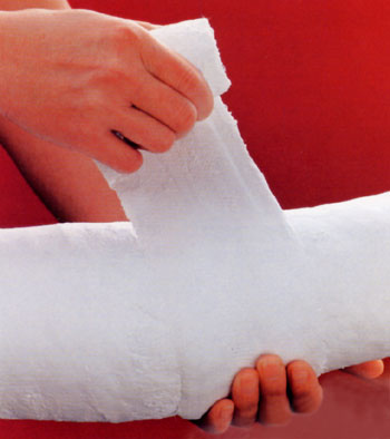 Best Plaster of Paris bandage