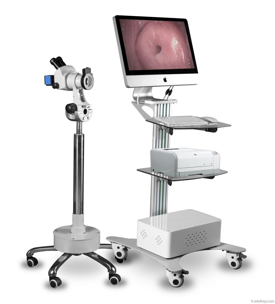 digital optical colposcope