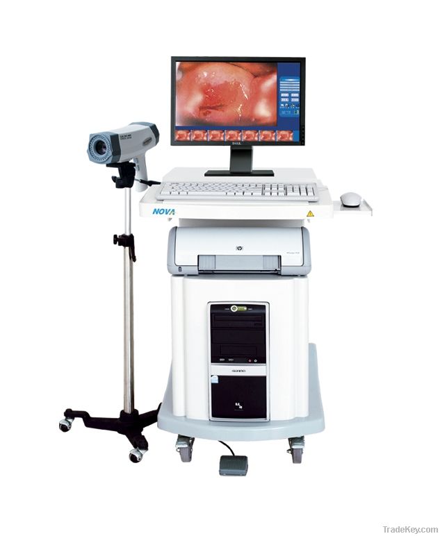 digital electronic colposcope