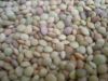 chinese lentils