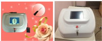 30Mhz high frequency spider veins removal vascular removal rbs