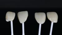 Zirconia Crowns | Durable &amp;amp;amp;amp;amp; Natural for Molars  e.max Crowns | Lifelike Translucency for Anterior Teeth