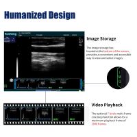 N60 Portable Ultrasound Machine With Clear
