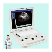 RS N20 Portable Ultrasound Machine With