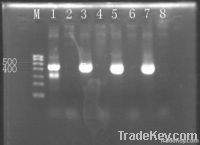 Recombinant pfu DNA polymerase