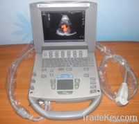 SONOSITE TITAN