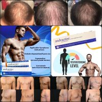 Treat Hormone Deficiencies In Men