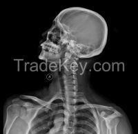 medical x-ray film/dry film