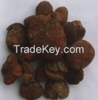 golden brown gallstone